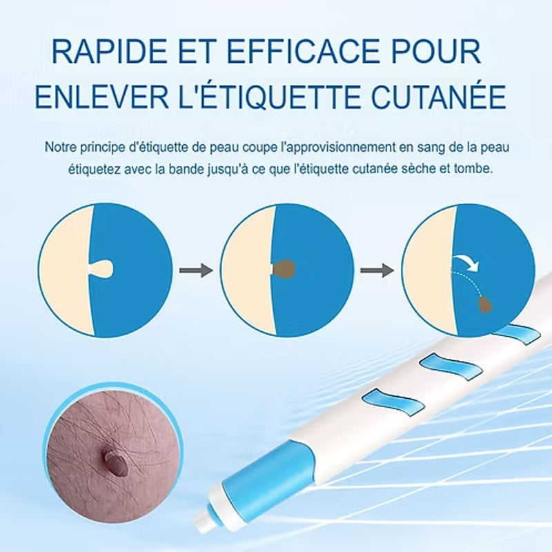 Kit ClearTag – Fini les excroissances cutanées