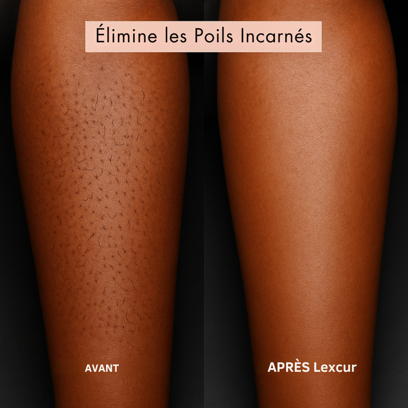 Rasoir LEXCUR® - L’innovation du rasage pour une peau lisse et éclatante