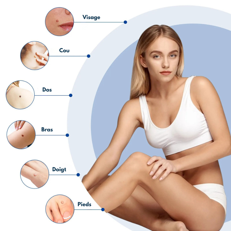 Kit ClearTag – Fini les excroissances cutanées