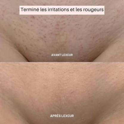 Rasoir LEXCUR® - L’innovation du rasage pour une peau lisse et éclatante